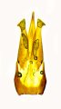Gnathodicrus hunanensis